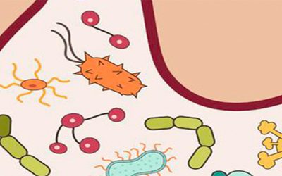 What Is SIBO?