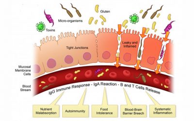 What Is Leaky Gut?