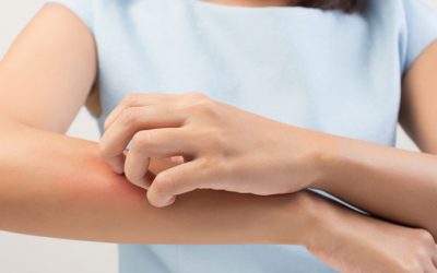 What exactly is Histamine Intolerance?