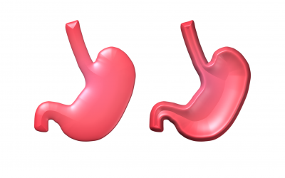 Testing for Low Stomach Acidity
